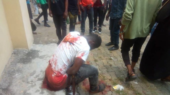RIVERS-PDP-INJURED-3-1024x576