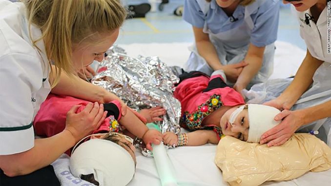 190716093526-01-safa-marwa-conjoined-twins-exlarge-169
