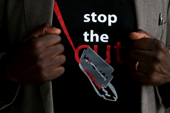 FGM